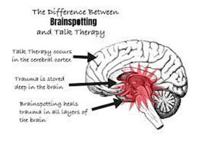 brainspotting